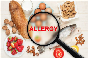 Allergy Image 